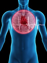 Inflammation Of The Sac Surrounding The Heart