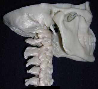 _3DSPINE.JPG