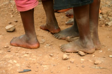 These poor children lack shoes. These poor children lack shoes.
