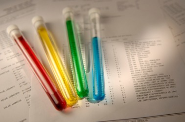 Vials of different colored liquids. Vials of different colored liquids.