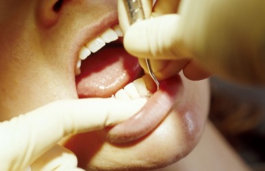 A patient is having plaque removed from his teeth by a dental hygienist. A patient is having plaque removed from his teeth by a dental hygienist.
