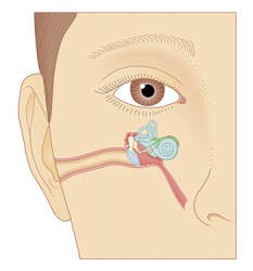 Meniere's Disease can cause sensorineural hearing loss because it affects the inner ear. Meniere's Disease can cause sensorineural hearing loss because it affects the inner ear.