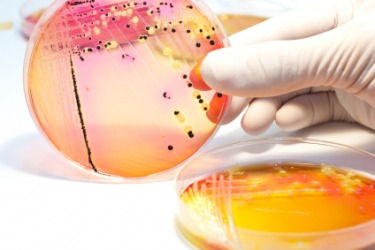 Bacteriology is the study of bacteria. Bacteriology is the study of bacteria.