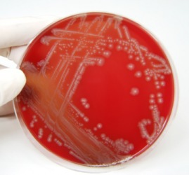 A dish containing the E. coli bacteria. A dish containing the E. coli bacteria.