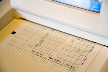 The readout from a heart monitor. The readout from a heart monitor.