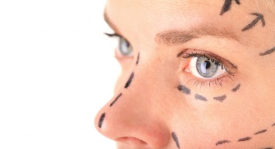 A woman prepares for a face lift. A woman prepares for a face lift.