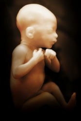 An image of a human fetus in utero. An image of a human fetus in utero.