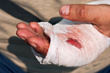 This person has an injury to their hand. This person has an injury to their hand.