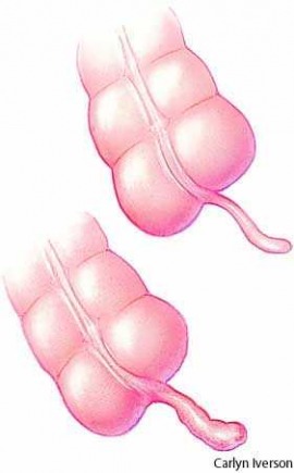 vermiform appendix