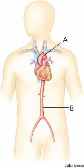 aorta