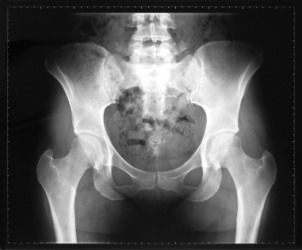 The bones of the pelvis. The bones of the pelvis.
