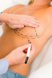 An example of augment is to have your breast enlarged. An example of augment is to have your breast enlarged.