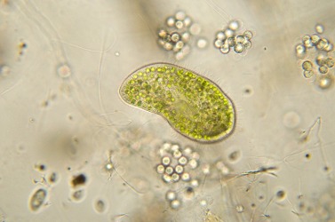 Paramecium bursaria is an example of a protist. Paramecium bursaria is an example of a protist.