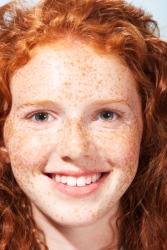 Red hair is a recessive gene but freckles are a dominant gene. Red hair is a recessive gene but freckles are a dominant gene.