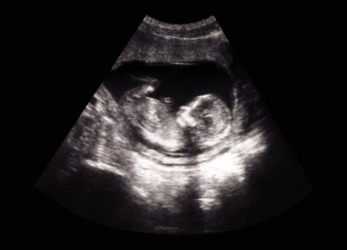 Fetology studies the fetus. Fetology studies the fetus.
