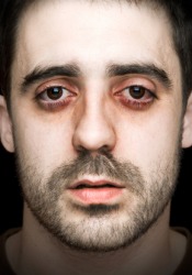 A man looking haggard. A man looking haggard.