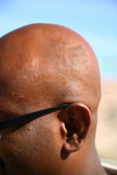 A bald man. A bald man.