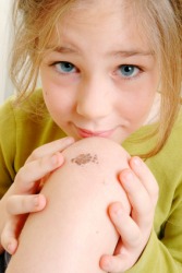 A litte girl with a minor wound. A litte girl with a minor wound.