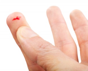 A small wound on a finger. A small wound on a finger.