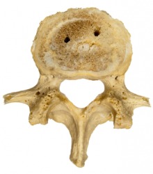 A single human vertebra. A single human vertebra.