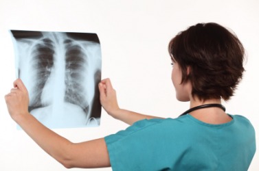 A doctor views an X-ray of a patient's chest. A doctor views an X-ray of a patient's chest.