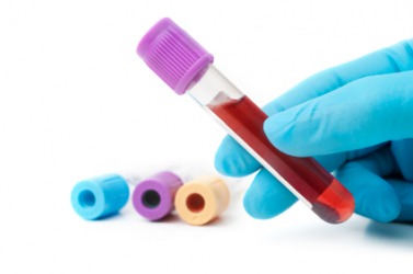 A vial of blood. A vial of blood.