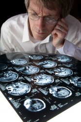 A man scans MRI brain scans. A man scans MRI brain scans.